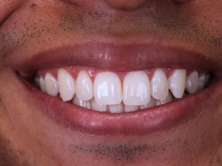 Sorriso de paciente da Dra. Fabiana Luchesi depois do clareamento dental